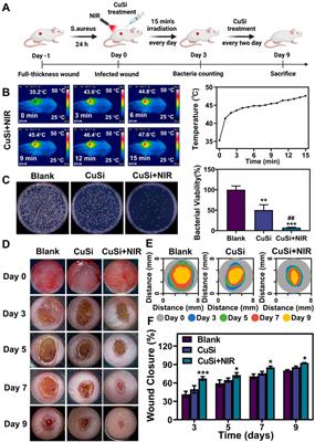 Mild-temperature photothermal assisted CuSi nanowires for promoting infected wound healing
